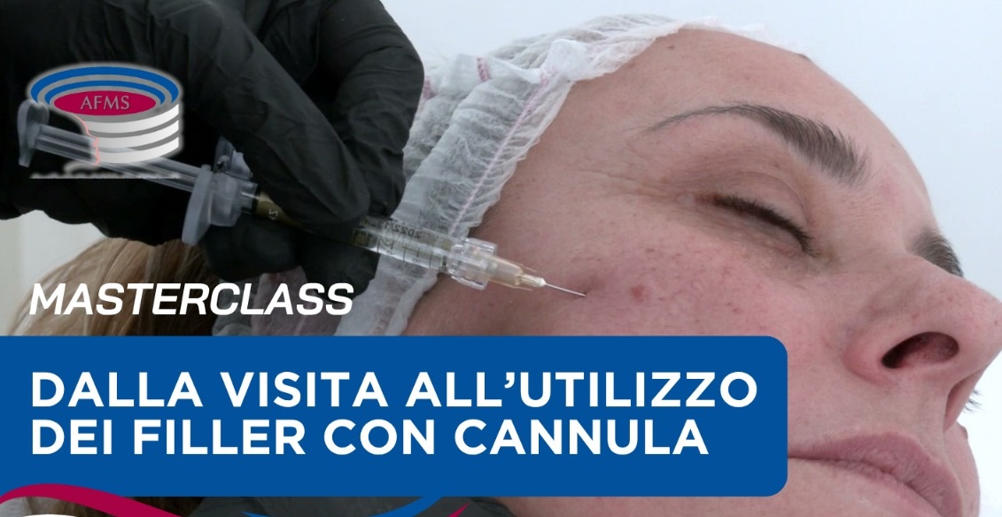 filler_con_cannula
